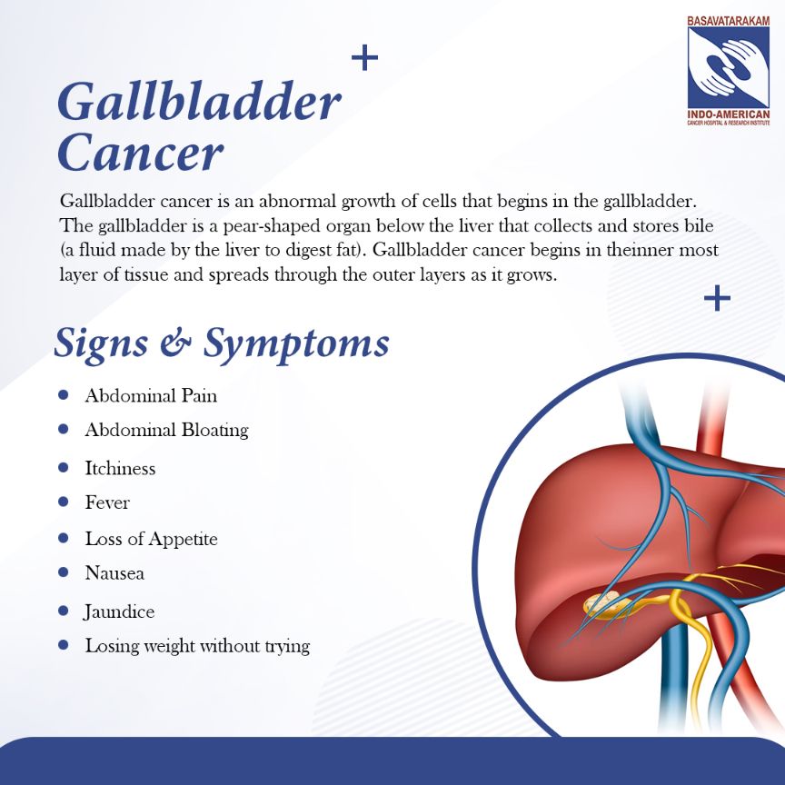gallbladder cancer signs and symptoms