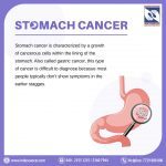 Stomach Cancer A Comprehensive Guide Induscancer