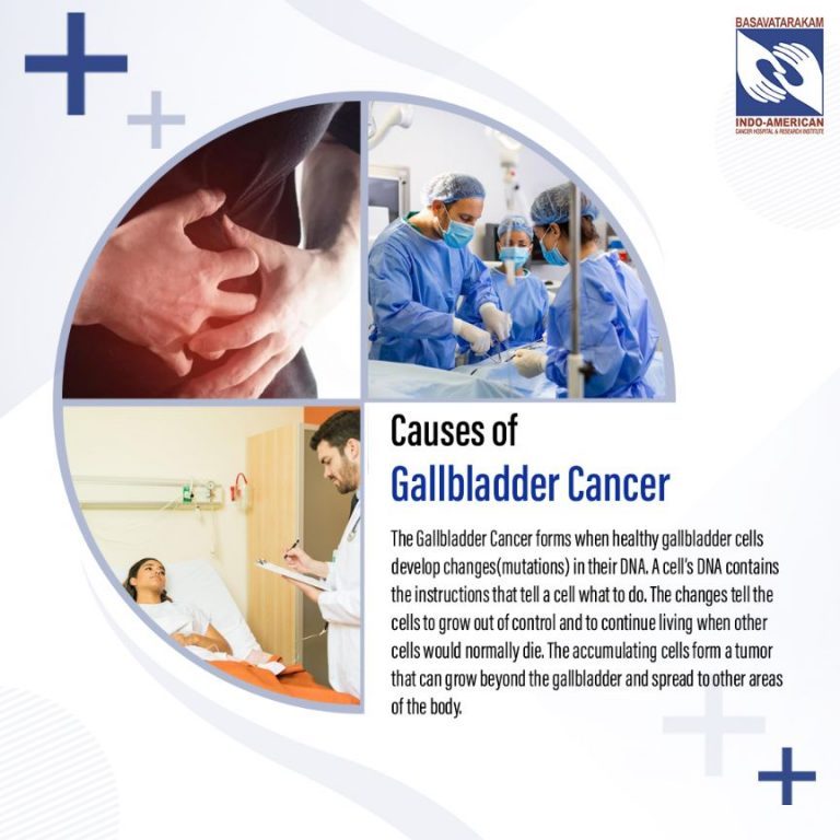 Gallbladder cancer - Signs - Symptoms and causes -Basavatarakam Indo ...