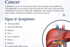 gallbladder cancer signs and symptoms