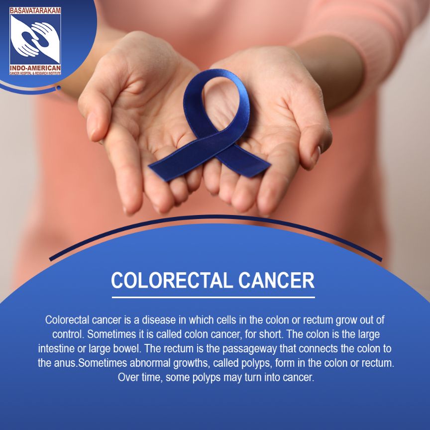 Colorectal Cancer or Colon-Rectal Cancer