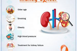 Kidney Cancer -Renal Cancer - Signs & Symptoms - Risk factors & Prevention oc Kidney Cancer - Basavatarakam Indo American Cancer Hospital