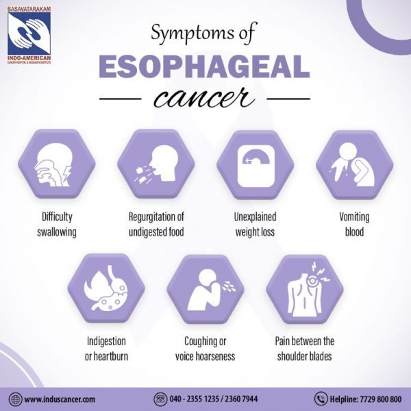 Esophageal Cancer: Causes, Symptoms, And Treatment Options At ...