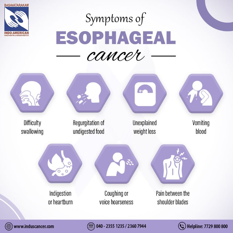 symptoms of esophageal cancer