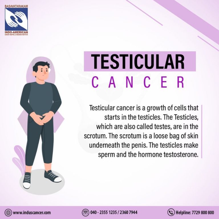 Testicular Cancer Signs And Symptoms, Diagnosis & Treatment 