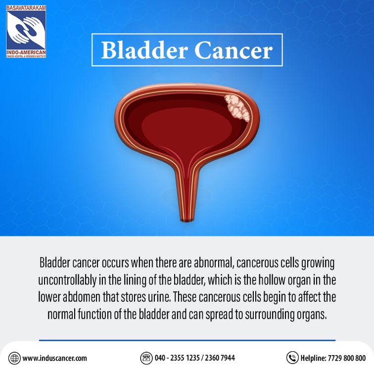 what is bladder cancer?