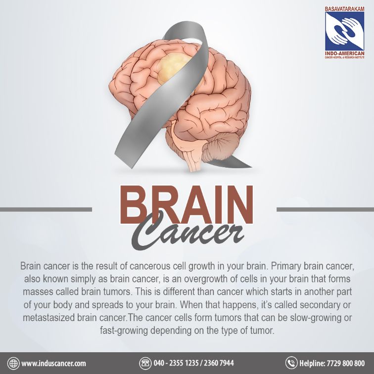 brain cancer - BRAIN TUMORS