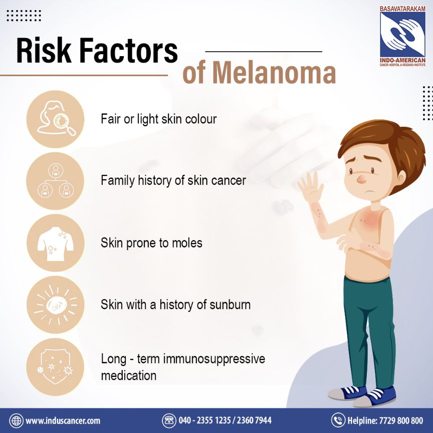 risk factors of melanoma