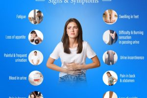 signs & sympots of bladder cancer