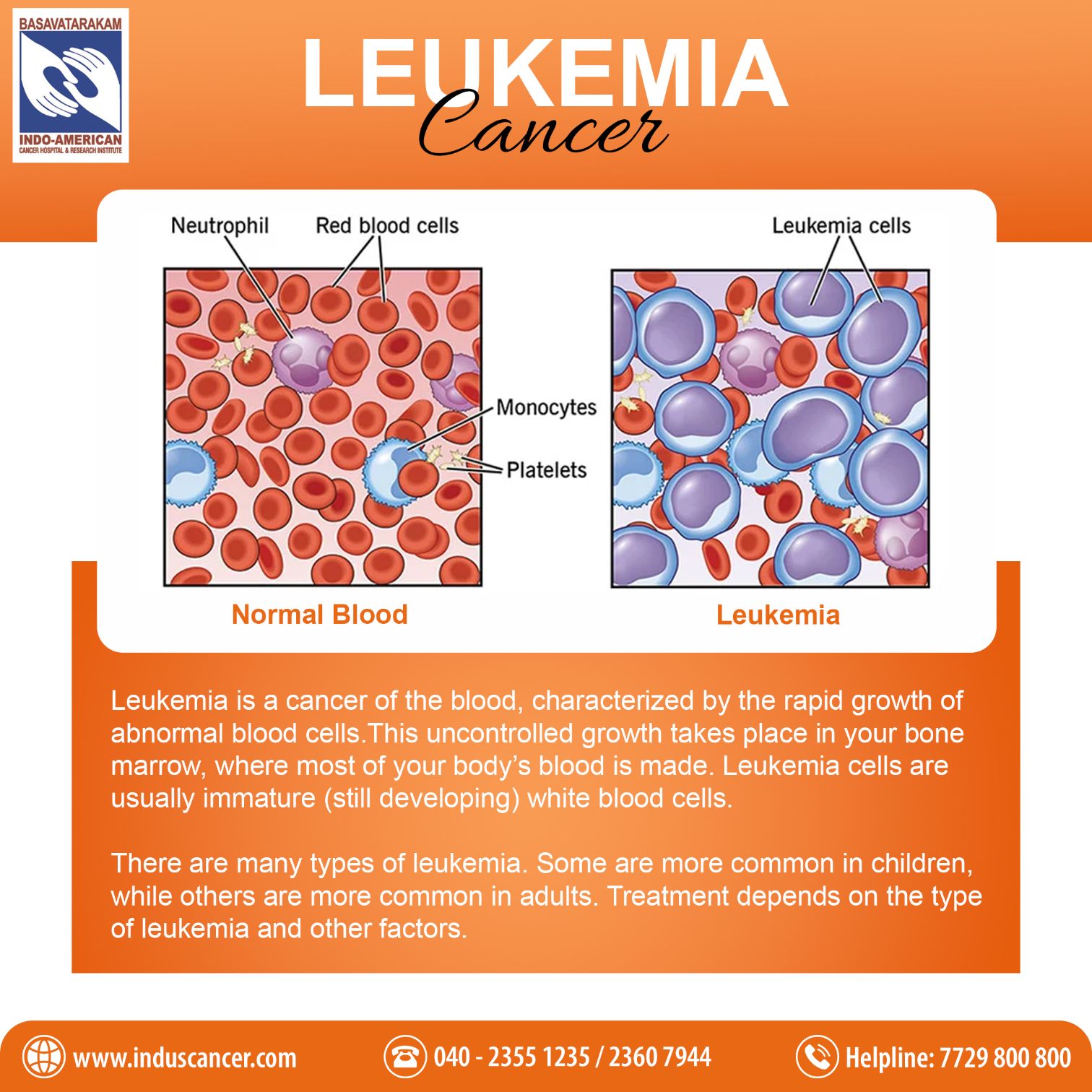 leukemia cells vs normal cells