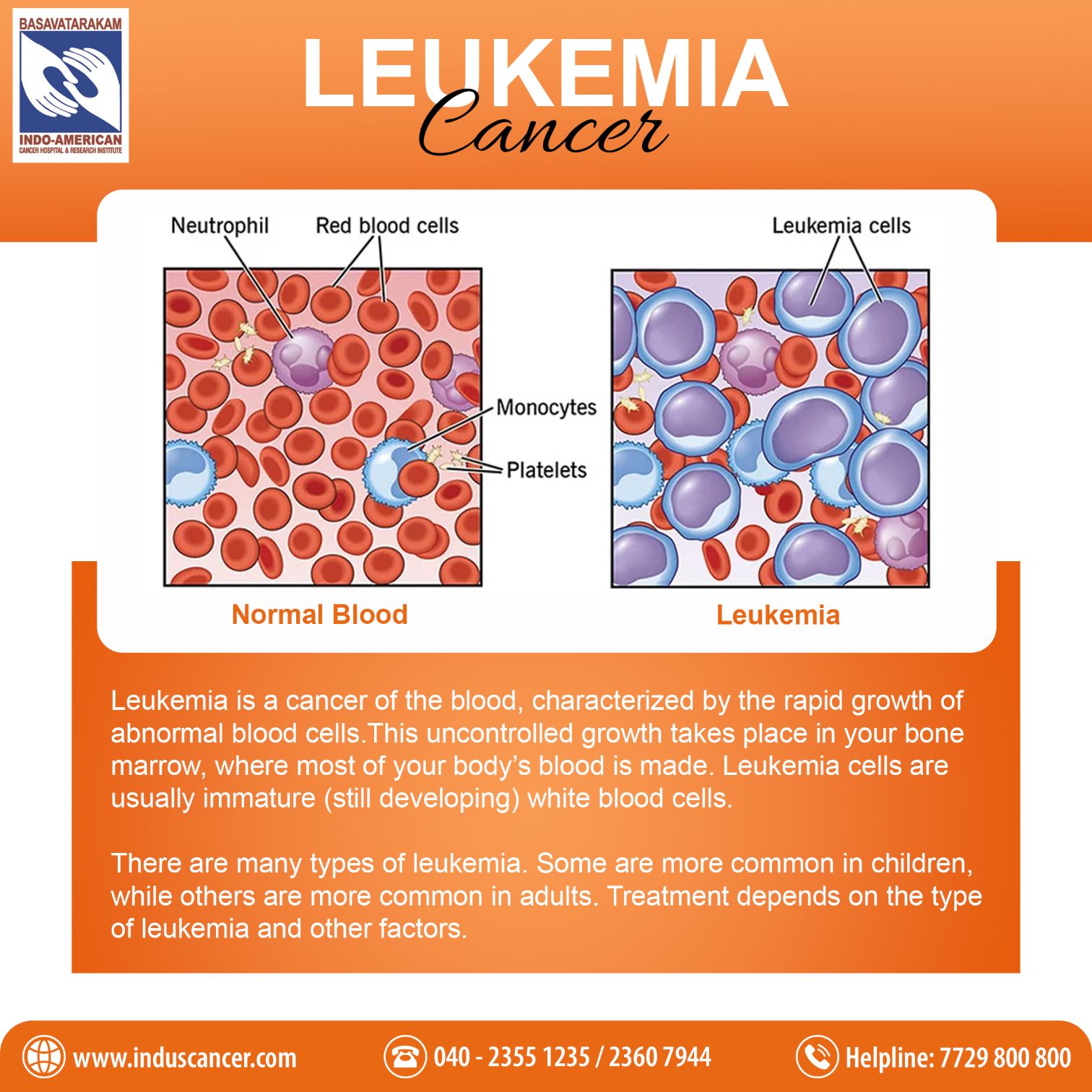 Comprehensive Guide To Leukemia Symptoms Causes Treatment Types 