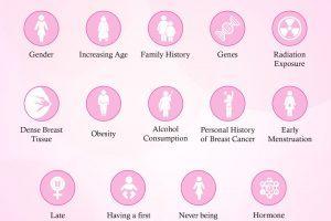 Risk Factors of Breast Cancer