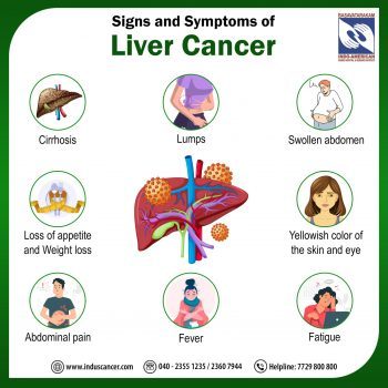Signs and Symptoms of Liver Cancer