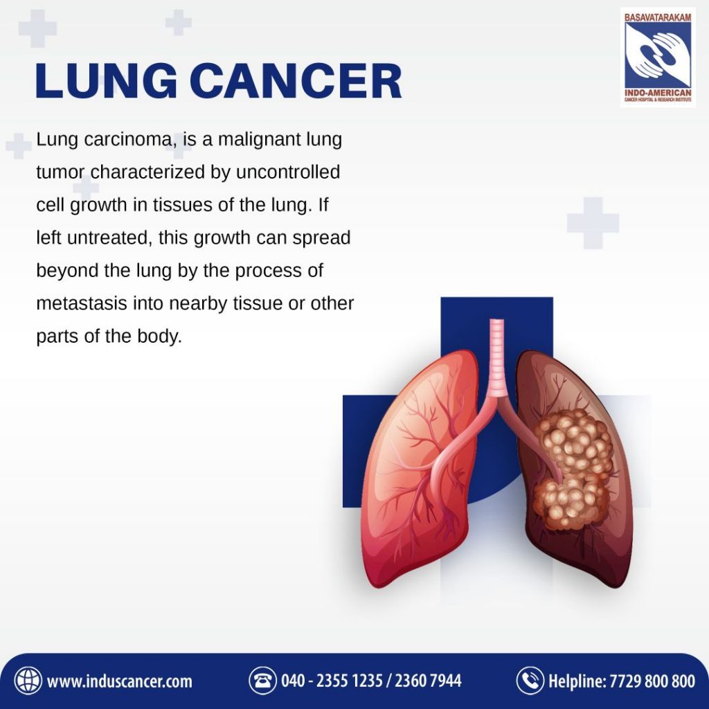 What is Lung Cancer?