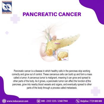 What is Pancreatic Cancer