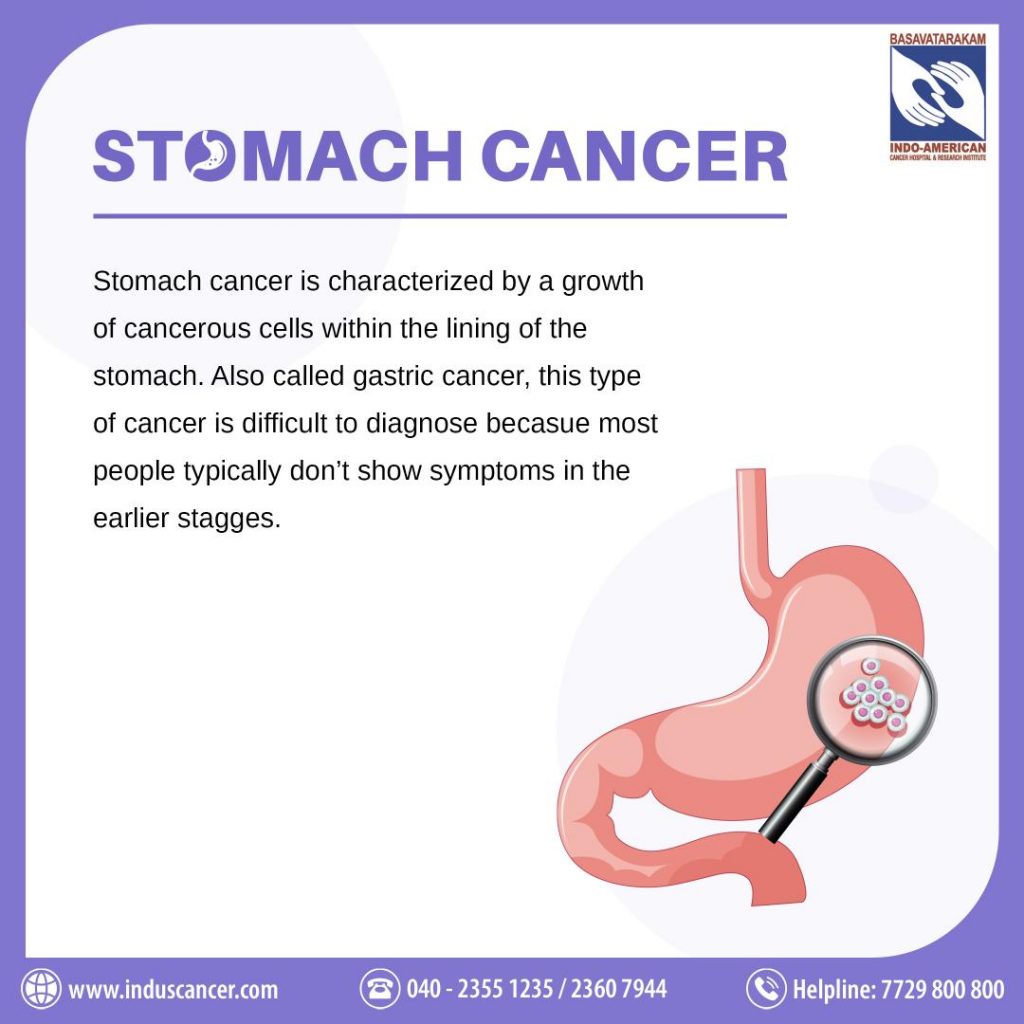 What is Stomach Cancer