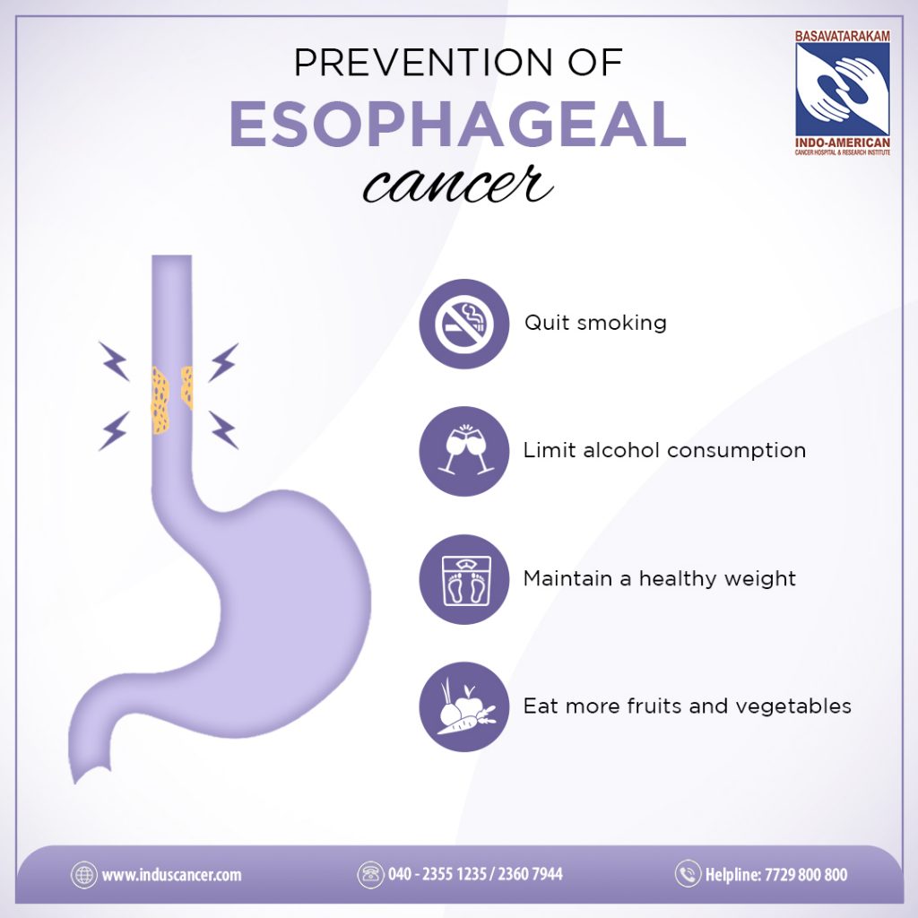 Prevention of Esophageal Cancer - Basavatarakam Indo American Cancer Hospital